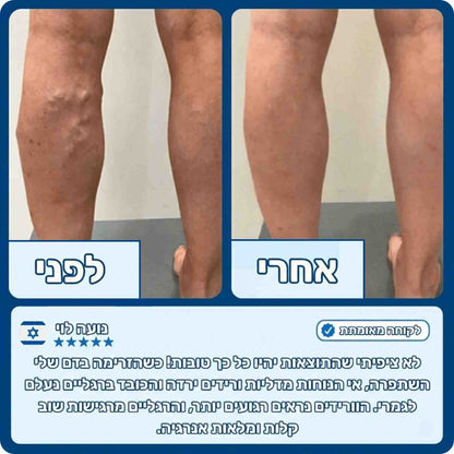 משטח התקרקעות - Steadystep